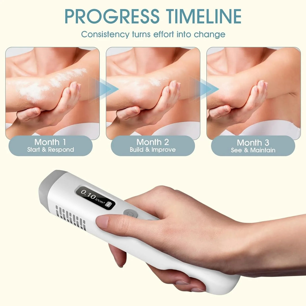 308nm UVB Light Therapy Device Handheld Narrowband Phototherapy Lamp with Adjustable Dose Digital Display 15x15mm Targeted Care Area Rechargeable Portable Home Use for Hands Arms Legs Neck Body Skin Care Includes Protective G